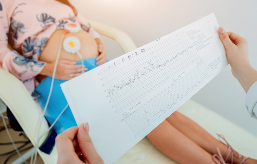 Fetal Heart Rate Monitoring and Birth Injuries in NJ: How to Identify Malpractice and Seek Compensation